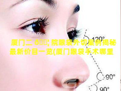 厦门二 🐦 院眼袋外切案例揭秘最新价目一览(厦门眼袋手术哪里 🌸 做的最好)